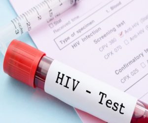 hiv-test-medicine-from isreal