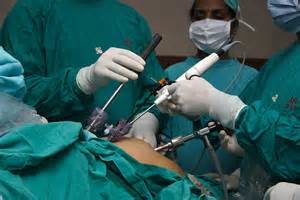 keralanews laparoscopic appendecectomy surgery started in thalasseri general hospital