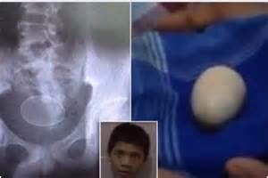 keralanews 14 year old boy laid 20 eggs since 2015