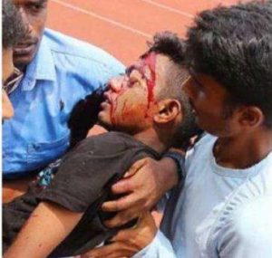 keralanews student was seriously injured during the hammer throw match and the junior athletic meet was postponed