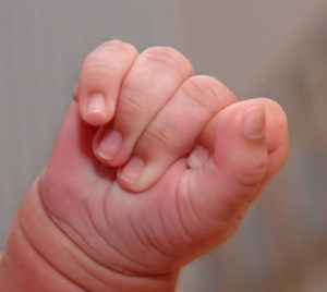 keralanews a girl with two heads was born in kasaragod