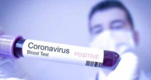 keralanews covid confirmed in man coming from abroad after quarantine period