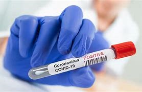 keralanews 7871 covid cases confirmed in the state today 4981 cured