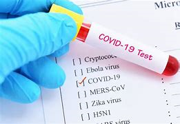 keralanews 7983 covid cases confirmed today 7330 cured