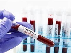 keralanews 6293 covid cases confirmed today in kerala 5290 cured