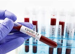 keralanews 2098 covid cases confirmed in the state today 2815 cured