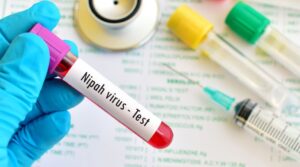 Blood sample for Nipah virus test