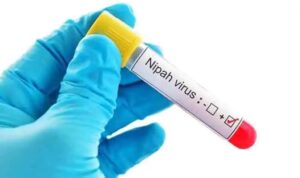 keralanews nipah confirmed again in thestate twelve year old boy died in kozhikode confirmed nipah virus infection