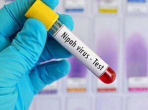 keralanews nipah test result of child died of fever in kasarkode chengala is negative